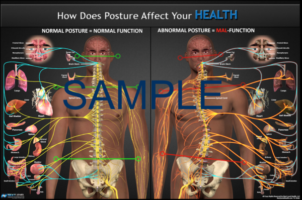 POSTURE POSTER 24X36 Digital Download - Image 2