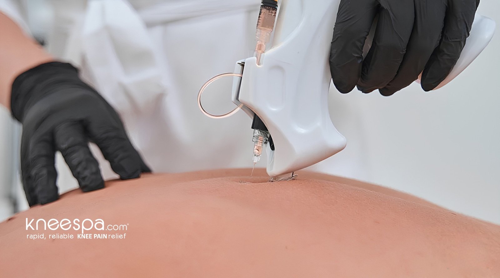 TPI as a treatment avenue