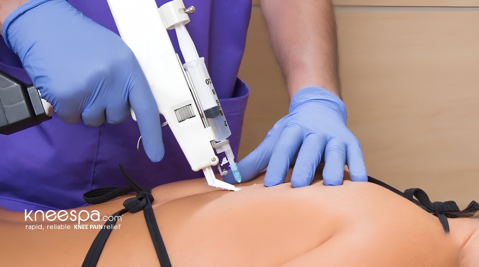 Trigger Point Injections
