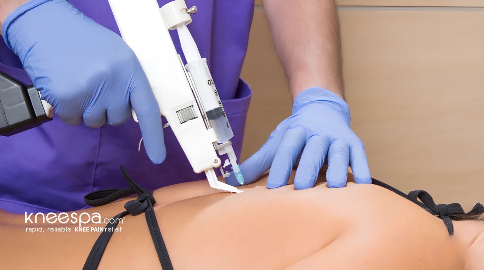 Trigger Point Injections