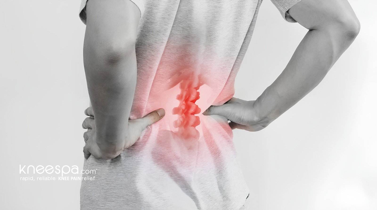 What is a Pinched Nerve?